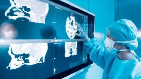 A veces graves: Cuáles son los efectos secundarios del prometedor medicamento contra el Alzheimer A veces graves: Cuáles son los efectos secundarios del prometedor medicamento contra el Alzheimer