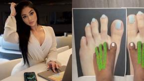 "Pies de gremlin": Influencer se hizo cirugía para acortar sus dedos y sus seguidores se burlaron "Pies de gremlin": Influencer se hizo cirugía para acortar sus dedos y sus seguidores se burlaron