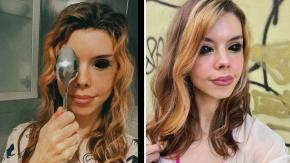 Joven terminó ciega tras intentar tatuarse los ojos: Quería copiar el look de su rapero favorito Joven terminó ciega tras intentar tatuarse los ojos: Quería copiar el look de su rapero favorito