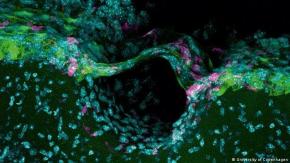 Científicos acaban de descubrir una nueva capa de la anatomía cerebral Científicos acaban de descubrir una nueva capa de la anatomía cerebral