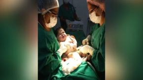 "Bebé gigante" en Brasil: Recién nacido pesó más de 7 kilos y midió casi 60 centímetros "Bebé gigante" en Brasil: Recién nacido pesó más de 7 kilos y midió casi 60 centímetros