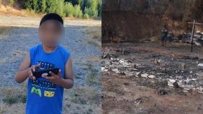 Familia pide ayuda para hijo que perdió su prótesis tras los incendios en Tomé Familia pide ayuda para hijo que perdió su prótesis tras los incendios en Tomé