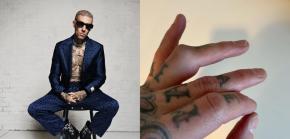 ¿Peligra la llegada de Blink-182 a Chile? Travis Barker debe someterse a cirugía ¿Peligra la llegada de Blink-182 a Chile? Travis Barker debe someterse a cirugía