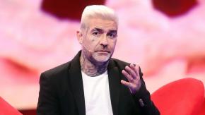 DJ Méndez se sometió a particular intervención facial: mostró en redes el antes y después