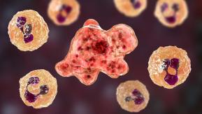 Persona murió tras infectarse con "ameba comecerebros" en Estados Unidos Persona murió tras infectarse con "ameba comecerebros" en Estados Unidos