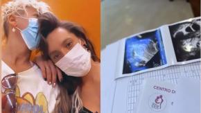 "Si les contara cuantos intentos llevamos": María Jimena Pereyra intenta ser mamá junto a su pareja "Si les contara cuantos intentos llevamos": María Jimena Pereyra intenta ser mamá junto a su pareja