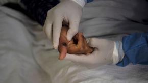 OMS levanta alerta máxima internacional por epidemia de viruela del mono OMS levanta alerta máxima internacional por epidemia de viruela del mono
