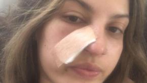 "Una limpieza facial me hizo descubrir que tenía cáncer" "Una limpieza facial me hizo descubrir que tenía cáncer"