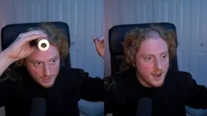 Streamer impacta a seguidores rapándose en plena transmisión y descubre extraña marca en su cráneo por el uso de audífonos Streamer impacta a seguidores rapándose en plena transmisión y descubre extraña marca en su cráneo por el uso de audífonos