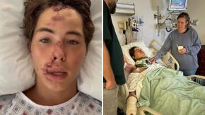 Tiktoker se salvó de milagro tras caer por acantilado de 24 metros: "Casi muero" Tiktoker se salvó de milagro tras caer por acantilado de 24 metros: "Casi muero"