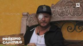 Se le rajó una parte del ojo: Detallan el accidente que sufrió Junior Playboy en “Tierra Brava”