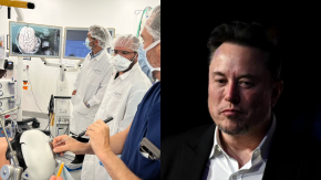 Telepathy: En qué consiste el microchip cerebral que implantó Neuralink, la empresa de Elon Musk Telepathy: En qué consiste el microchip cerebral que implantó Neuralink, la empresa de Elon Musk