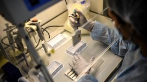 ¿Qué es un obelisco? La molécula biológica presente en humanos que había pasado desapercibida hasta ahora ¿Qué es un obelisco? La molécula biológica presente en humanos que había pasado desapercibida hasta ahora
