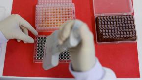 Detectan influenza aviar en persona que tuvo contacto con vacas contagiadas