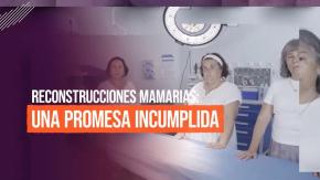 Reportajes T13: Mujeres en lista de espera hasta 21 años por una reconstrucción mamaria Reportajes T13: Mujeres en lista de espera hasta 21 años por una reconstrucción mamaria