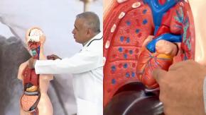 Influenza: ¿Cuándo puede causar neumonía grave y de qué depende que una persona se complique? Influenza: ¿Cuándo puede causar neumonía grave y de qué depende que una persona se complique?