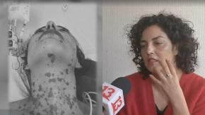 Mujer denuncia que vive calvario por consumo de medicamento: le provocó grave síndrome Mujer denuncia que vive calvario por consumo de medicamento: le provocó grave síndrome