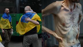 El estremecedor estado de un prisionero ucraniano que fue liberado tras dos años de cautiverio en Rusia El estremecedor estado de un prisionero ucraniano que fue liberado tras dos años de cautiverio en Rusia
