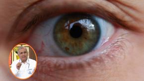 ¿Sientes que te tirita un ojo? Estas pueden ser las causas y atención con un "secreto" del doctor Ugarte ¿Sientes que te tirita un ojo? Estas pueden ser las causas y atención con un "secreto" del doctor Ugarte