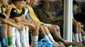 Impactante: Así quedó el tobillo derecho de Lionel Messi tras abandonar lesionado la final de Copa América
