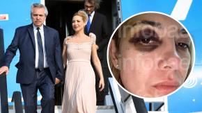 “Todo el tiempo me golpeas”: Revelan chats y fotos de la denuncia de Fabiola Yáñez contra Alberto Fernández