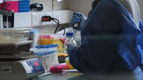 Seremi de Salud de Tarapacá confirma que existió caso importado de viruela del mono Seremi de Salud de Tarapacá confirma que existió caso importado de viruela del mono