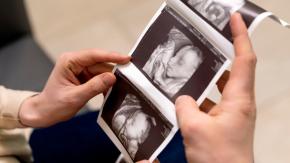 ¿Cómo se decide el sexo biológico durante la gestación? ¿Cómo se decide el sexo biológico durante la gestación?