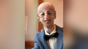 Muere Sammy Basso, la persona con progeria más longeva del mundo