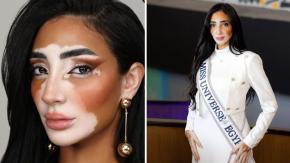 Miss Egipto se convierte en la primera candidata en la historia de Miss Universo con vitiligo 