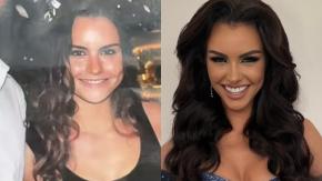 Emilia Dides aclaró que no tiene operaciones en su rostro tras compartir foto de cómo era hace un año: "No inventen"