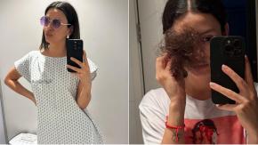 Karla Melo se sincera sobre su quimioterapia y la pérdida de su cabello: "Emocionalmente es duro"