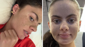 Cuestionan a tiktoker por promover el "anti skincare": lleva semanas sin lavarse la cara