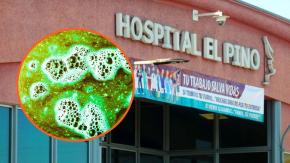 Confirman dos casos de aspergilosis en el Hospital El Pino: Cuáles son los síntomas de esta infección Confirman dos casos de aspergilosis en el Hospital El Pino: Cuáles son los síntomas de esta infección