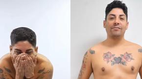 Botota Fox impacta al presumir resultados a dos meses de su cirugía estética: mostró el antes y el ahora