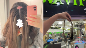 Joven que denunció a peluquería de Quilpué por quemaduras revela que no podrá recuperar su pelo