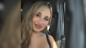 Perla Ilich se sometió a procedimiento estético y mostró su antes y después: "Me hace sentir mucho mejor"