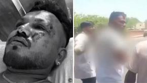 “Lo vi todo con mis ojos”: El dramático relato del único sobreviviente de accidente de avión en India