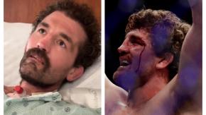 La impactante imagen de icónico ex luchador de Estados Unidos en hospital: fue trasplantado y "murió 4 veces"