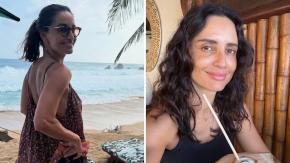 El doloroso accidente que sufrió Leonor Varela: terminó con triple fractura de hueso
