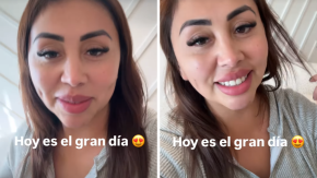 Naya Fácil se sometió a nuevo procedimiento estético: mostró su increíble antes y después Naya Fácil se sometió a nuevo procedimiento estético: mostró su increíble antes y después