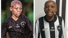 Le cayó agua hirviendo con un año de edad: La increíble historia de superación de la nueva promesa del Botafogo de Brasil Le cayó agua hirviendo con un año de edad: La increíble historia de superación de la nueva promesa del Botafogo de Brasil