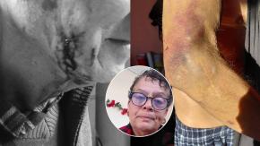 Madre hace desesperado llamado para internar a su hijo de 34 años: él tiene problemas psiquiátricos y la agrede brutalmente