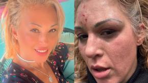 "Creí que me iba a matar": Ex Mekano, Ariela Medeiros, hizo crudo relato de brutal golpiza que le propino su pareja "Creí que me iba a matar": Ex Mekano, Ariela Medeiros, hizo crudo relato de brutal golpiza que le propino su pareja