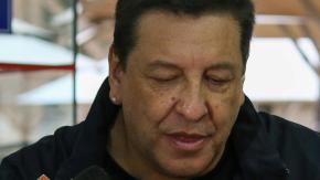 Julio César Rodríguez sorprende con nuevo look tras someterse a armonización facial Julio César Rodríguez sorprende con nuevo look tras someterse a armonización facial