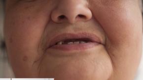 Más de medio millón de personas en lista de espera: la silenciosa crisis dental que golpea a Chile Más de medio millón de personas en lista de espera: la silenciosa crisis dental que golpea a Chile