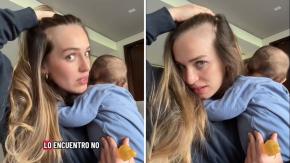 Tiktoker impacta con gran pérdida de pelo durante la lactancia: especialista explica por qué sucede y cómo combatirlo Tiktoker impacta con gran pérdida de pelo durante la lactancia: especialista explica por qué sucede y cómo combatirlo