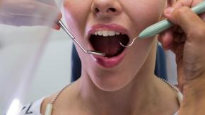 85% de los diagnósticos de cáncer oral son tardíos: A qué síntomas estar alerta y cuáles son los factores de riesgo 85% de los diagnósticos de cáncer oral son tardíos: A qué síntomas estar alerta y cuáles son los factores de riesgo