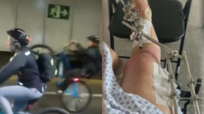 Ciclista quedó con múltiples fracturas tras ser atropellada por sujeto que realizaba maniobras: responsable se fugó