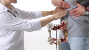 La condición médica que podría ser clave en el aumento de diagnósticos de cáncer colorrectal en jóvenes