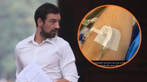 Alcalde Vodanovic fue hospitalizado por amigdalitis: “Ando medio quemado parece”